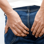 How to Treat the Agony of Hemorrhoids with Natural Remedies