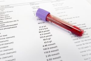 Blood Test Vitamin D Levels