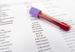 Blood Test Vitamin D Levels